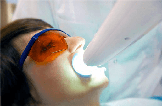 Understanding the Causes of Teeth Sensitivity Kettering