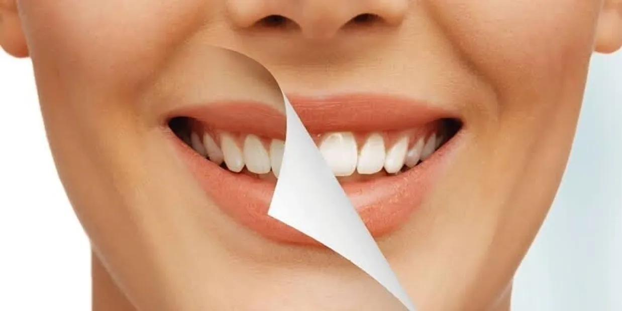 What Is Cosmetic Dentistry and How Can It Transform Your Smile Kettering
