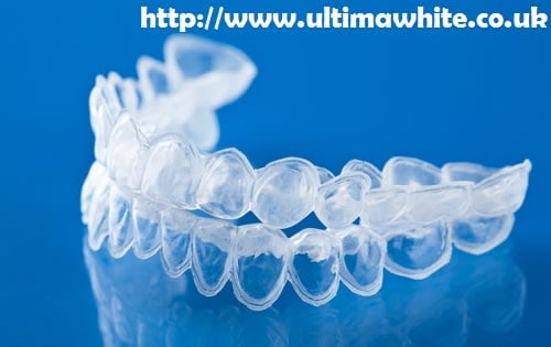 Bleaching Trays vs At-Home Laser Teeth Whitening Kettering