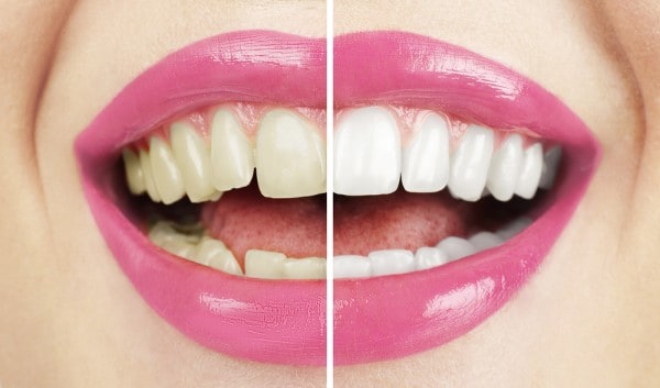 What Early Signs of Oral Cancer Should You Never Ignore Kettering?