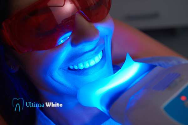 Professional Teeth Whitening Options Kettering