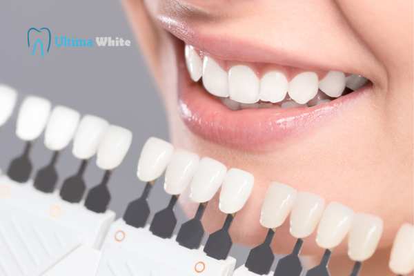 How to Maximise the Results of Your Laser Teeth Whitening Treatment Kettering