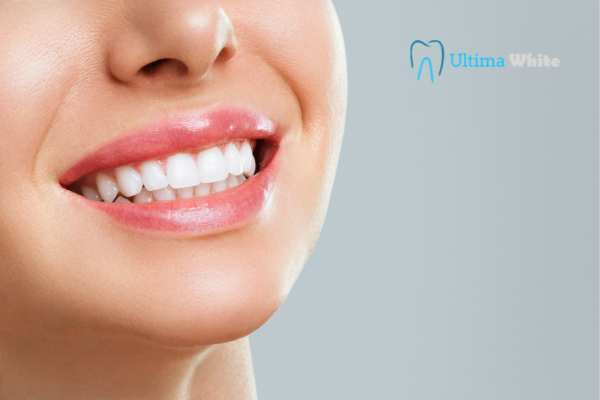 Common Mistakes That Can Ruin Your Whitening Results Kettering