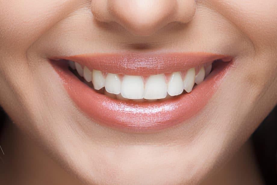 Beyond Whitening: How Your Daily Diet Affects Long-Term Smile Brightness Kettering