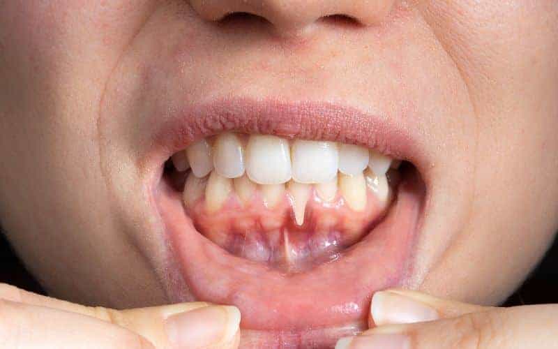 Final Thoughts: Building Lifelong Enamel Protection Habits Kettering