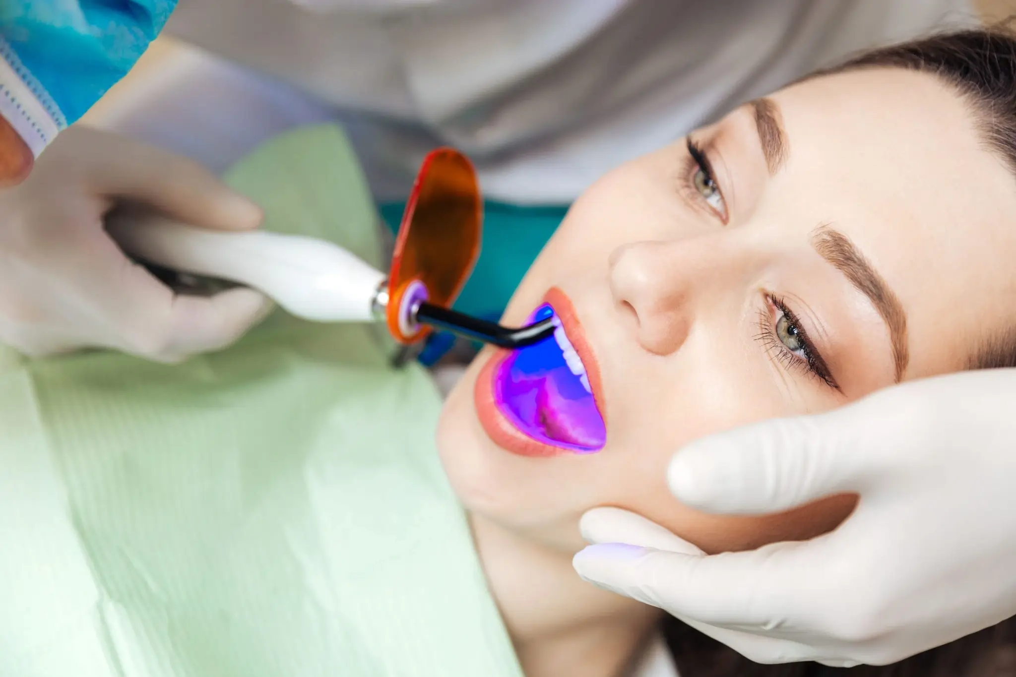 What Does Pain Feel Like During and After Laser Teeth Whitening Kettering?