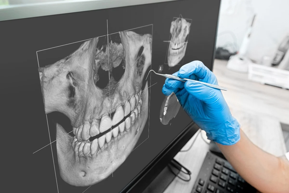 Key Benefits of 3D Printing for Patients and Dentists Kettering