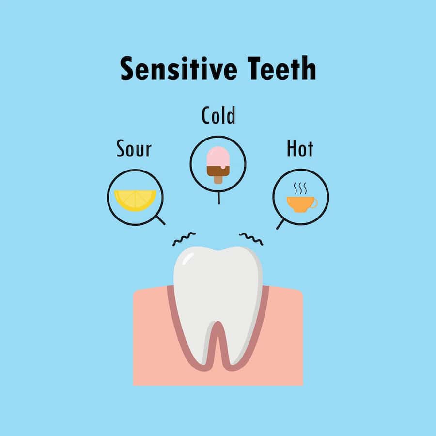 How Can You Tell If Your Teeth Are Becoming Sensitive Kettering?