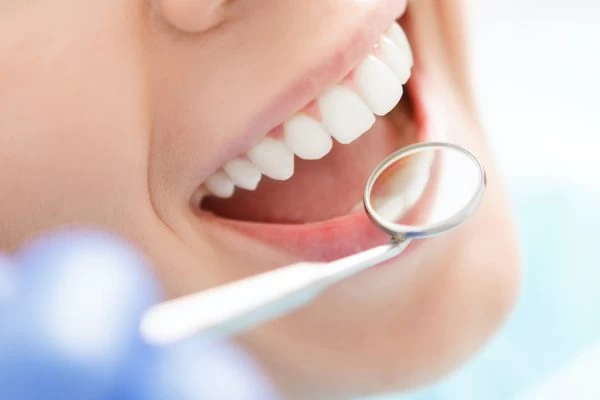 The Science Behind Natural Whitening: Myth vs Reality Kettering