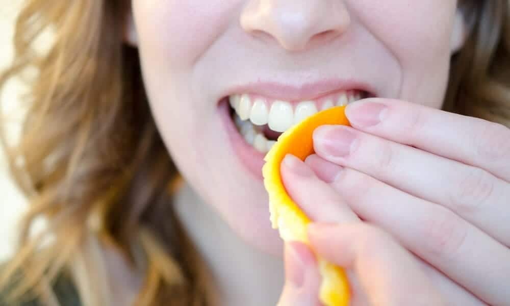 How Long Does Natural Teeth Whitening Take to Show Results Kettering?