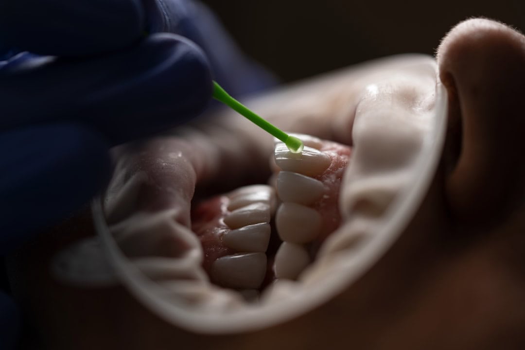 Common Causes of Persistent Dry Mouth Kettering