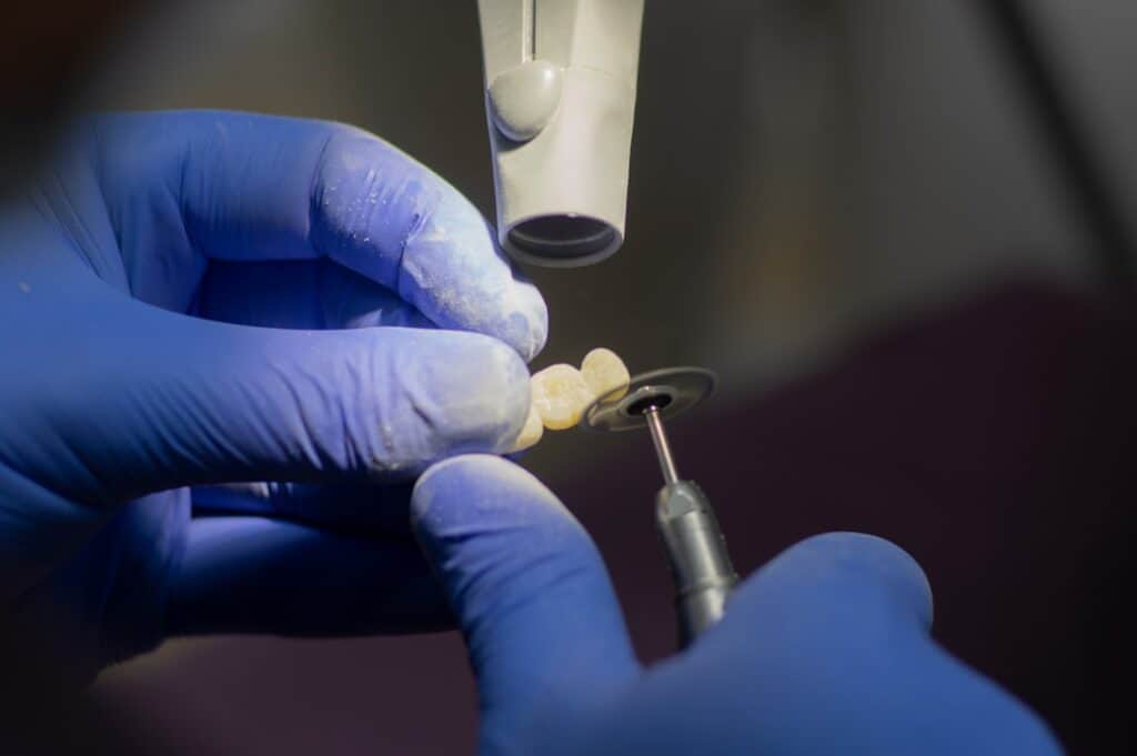 Customised Dental Solutions: Crowns, Aligners, and Implants Kettering