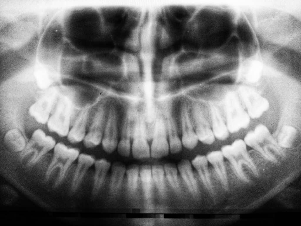 The Future of 3D Printing in Oral Healthcare Kettering